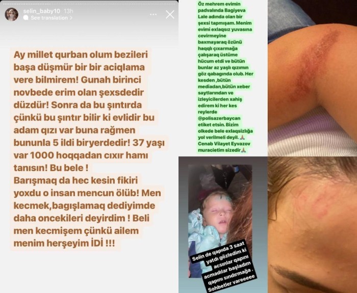 Bloger ərinin voleybolçu sevgilisi tərəfindən döyülüb - İDDİA  (FOTOLAR)